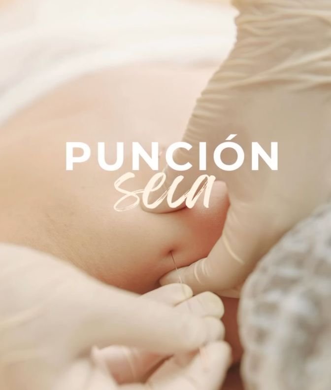 Punción Seca